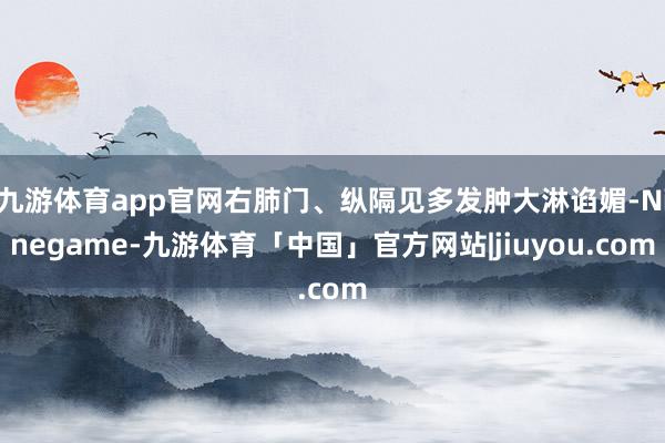 九游体育app官网右肺门、纵隔见多发肿大淋谄媚-Ninegame-九游体育「中国」官方网站|jiuyou.com