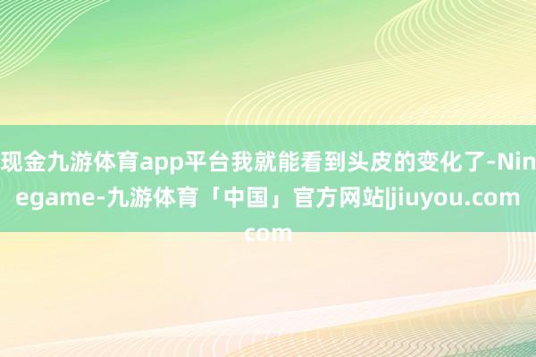 现金九游体育app平台我就能看到头皮的变化了-Ninegame-九游体育「中国」官方网站|jiuyou.com